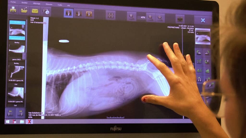 Radiographie